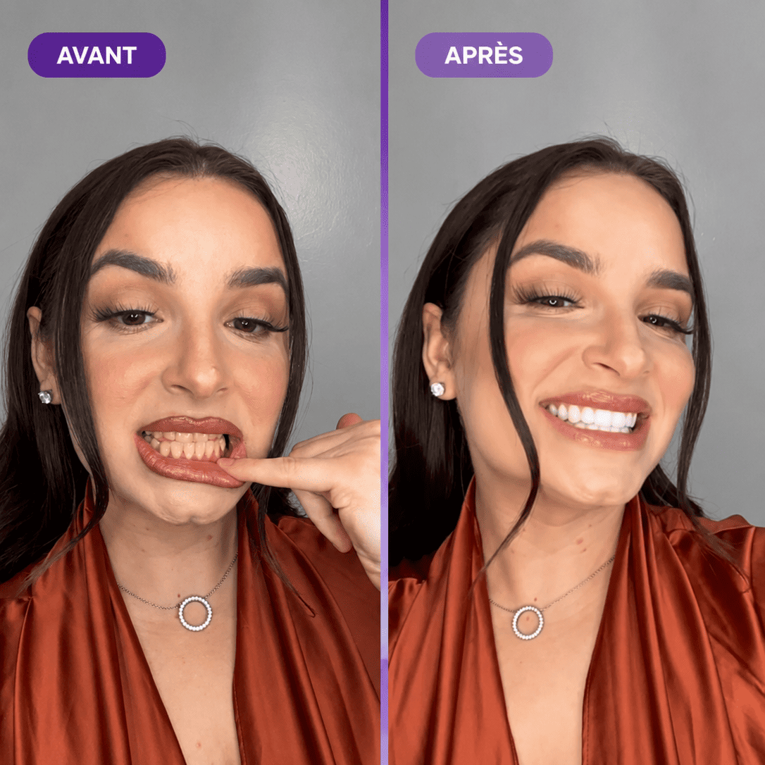 Souriez enfin sans penser à la couleur de vos dents en seulement 30 secondes.