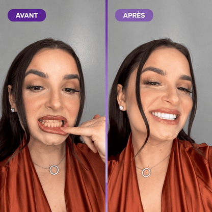 Souriez enfin sans penser à la couleur de vos dents en seulement 30 secondes.